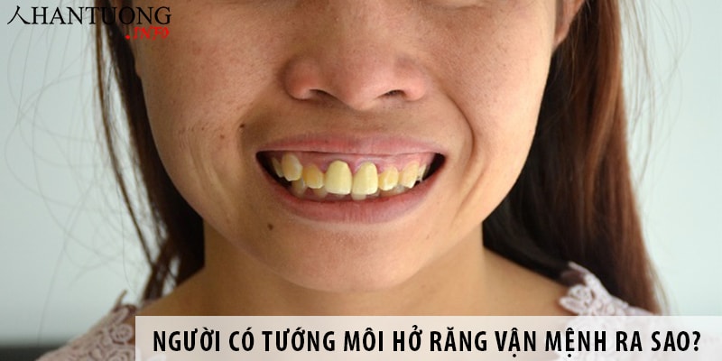 Người có tướng môi hở răng, miệng không khép chặt vận mệnh ra sao? Người có tướng môi hở răng vận mệnh ra sao?