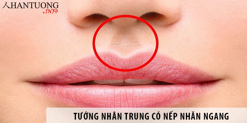 Tướng nhân trung có nếp nhăn ngang – luận giải vận mệnh Tướng nhân trung có nếp nhăn ngang - luận giải vận mệnh