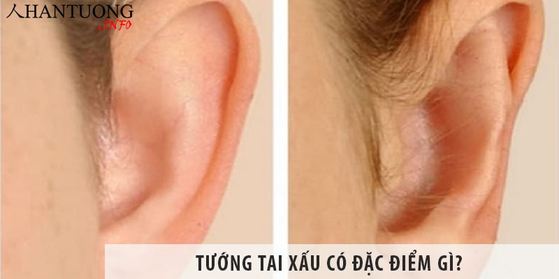 Tướng tai xấu có đặc điểm gì? – Tổng hợp những tướng tai xấu Tướng tai xấu có đặc điểm gì? - Tổng hợp những tướng tai xấu