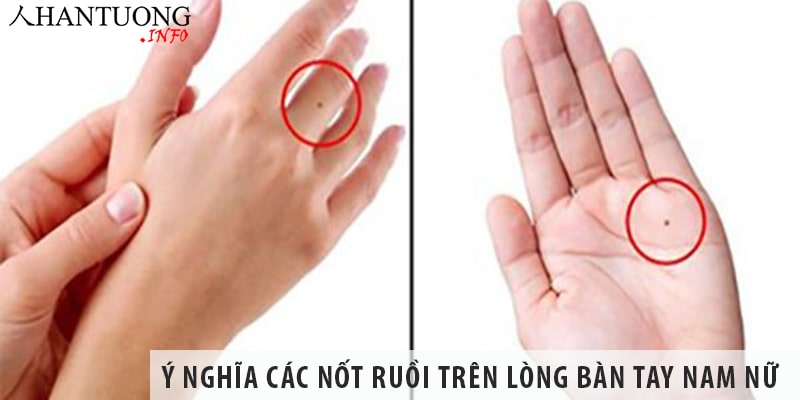 Ý nghĩa các nốt ruồi trên lòng bàn tay nam nữ Ý nghĩa các nốt ruồi trên lòng bàn tay nam nữ