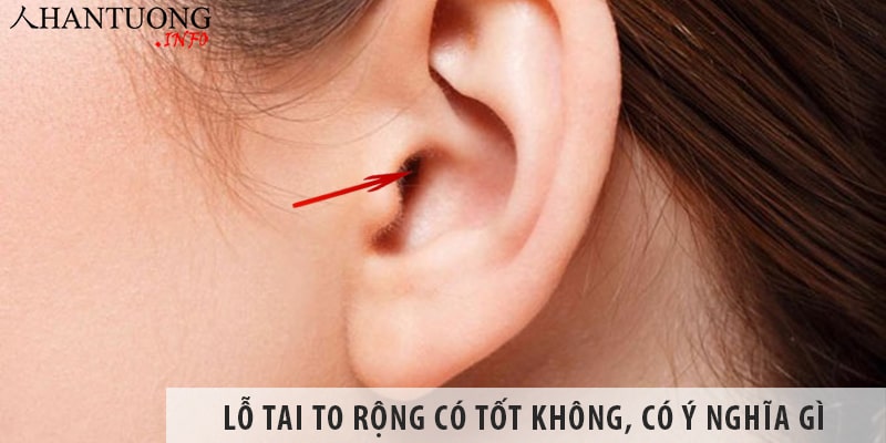 Lỗ tai to rộng có tốt không, lỗ tai to có ý nghĩa gì? Lỗ tai to rộng có tốt không, lỗ tai to có ý nghĩa gì?