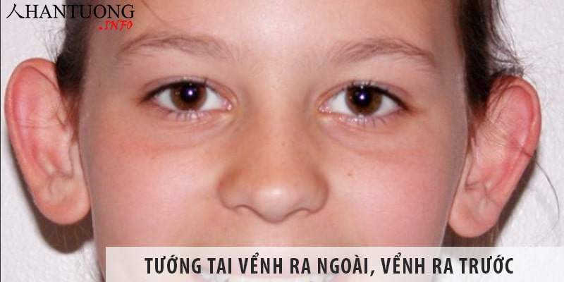 Tướng tai vểnh ra ngoài, vểnh ra trước có tốt không? Tướng tai vểnh ra ngoài, vểnh ra trước có tốt không?