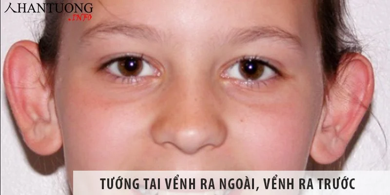 Tướng tai vểnh ra ngoài, vểnh ra trước có tốt không? Tướng tai vểnh ra ngoài, vểnh ra trước có tốt không?
