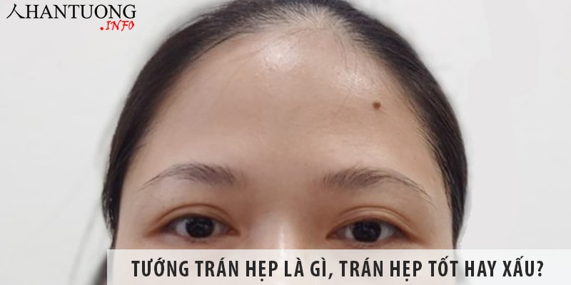 Tướng trán hẹp tốt hay xấu, mệnh vận ra sao, tâm tính thế nào Tướng trán hẹp là gì, trán hẹp tốt hay xấu?